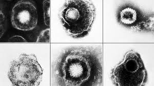 Positive hsv controls [herpes simplex type 1 and type 2 virus strains for preparing positive controls are available from various sources. Flawed Herpes Testing Leads To False Positives Needless Suffering Stat