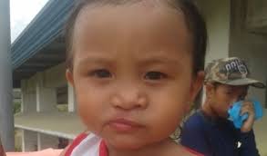 Success! Sabrina from the Philippines raised $69 to fund a cleft lip and  palate repair.