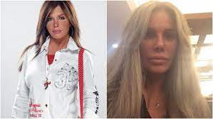 مي عز الدين قبل عملية التجميل. ØµÙˆØ± ØµØ§Ø¯Ù…Ø© 15 Ù†Ø¬Ù…Ø© ØªØ´ÙˆÙ‡Ù† Ø¨Ø¹Ø¯ Ø¹Ù…Ù„ÙŠØ§Øª Ø§Ù„ØªØ¬Ù…ÙŠÙ„ Ù…Ø¬Ù„Ø© Ø§Ù„Ø¬Ù…ÙŠÙ„Ø©
