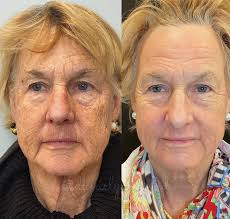 Daniel Yanes, MD, FAAD (@danielyanesmd) • Instagram photos and videos