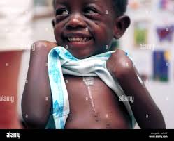 Scar year hi-res stock photography and images