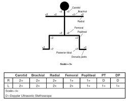 Peripheral Pulses Charting Related Keywords Suggestions