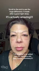 Peter Thomas Roth Eye Tightener Review