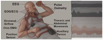 Image result for Polysomnogram