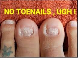 To put this in perspective, the average grain of short rice is about 5.5 mm long. I Have No Toenails Getting Ready For New Toenails More Info Youtube Toe Nails Acrylic Toe Nails Pretty Toe Nails