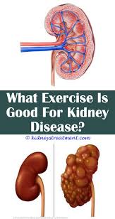 Kidney Stones Nutrition Kidney Disease Symptoms Kidney Disease Recipes Kidney Disease