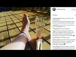 Read more about melanoma skin cancer; Woman Who Lost Foot To Cancer Features It On Instagram Youtube