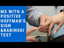 Image result for Hoffman Sign