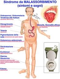 La scarsità di piastrine (piastrinopenia o trombocitopenia) può essere causata da diverse condizioni e patologie, le cui cause tipicamente ricadono in una di queste categorie Malassorbimento Celiachia Morbo Celiaco Sintomi Malassorbimento Sintomo Mal Assorbimento Stomaco Malassorbimento Intestinale Intestino Lattosio Mal Assorbimento Gastrico Stomaco Sindrome Da Malassorbimento Grasso Intestino Intestinale Feci Gialle