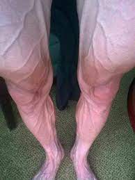 Sports > list > cycling > testing > anthropometry > tour de france. Tour De France Cyclist Shares What 16 Stages Do To A Rider S Legs The New Daily