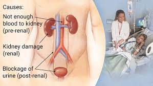 Environmental Toxins That Cause Kidney Disease And Failure