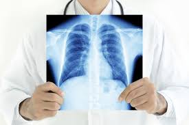 O reteta naturala de curatare a plamanilor. Cum SÄ IÈi CureÈi PlÄmanii 3 Tehnici Simple Pe Care Le PoÈi Face AcasÄ Stiridinlume Ro