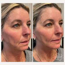 Join us tomorrow at 11:30 AM for a Facebook Live ZO Skin Health Event with  Tiffin Plaisted-Woosley, Esthetician and Tabitha Lilly from ZO. We will be  talking all the things..... from at-home