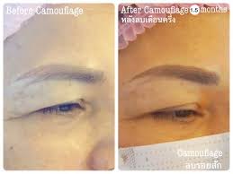 Ask your esthetician what peels can safely be used on the eyebrows. Eyebrow Tattoo Removal