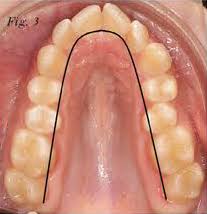 Respiracion Bucal Dentalmesquida Com