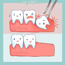 Share your questions through the comment section below. 51 Best Wisdom Tooth Extraction In Kuala Lumpur Price Guide Reviews