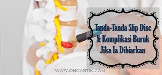 Tanda also seamlessly integrates with payroll and pos. Tanda Tanda Slip Disc Ohcantik Com