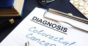 What are bowel cancer signs and symptoms? Signs And Symptoms Of Colorectal Cancer Gi Associates