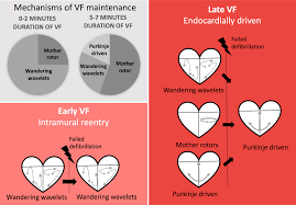 Endocardial Activation Drives Activation Patterns During Long Duration Ventricular Fibrillation And Defibrillation Circulation Arrhythmia And Electrophysiology