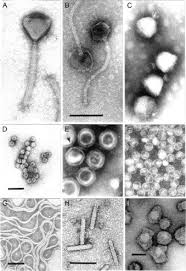 A restriction map is generated by using information gained from the electro. Bacteriophage Electron Microscopy Sciencedirect