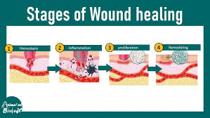 Image result for Wound Repair