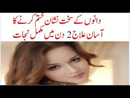 Garmi danay ka ilaj in urdu, treatment of garmi danay, garmi ke dane ka ilaj, garmi danay ki english, garmi dano k totkay, garmi dano se nijat in urdu, . Dano Ka Ilaj Bataye