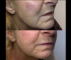 نمایه ‏‎Elevate Evansville‎‏‎