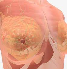 Breast cancer is also classified according to other characteristics. Stage 4 Breast Cancer Symptoms And Prognosis