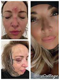 I've been smoke free for 28 years. I know many people who smoke.I know  people who have smoked and lived to be in their 90s. I lived with a smoker  for over