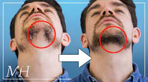 Home remedies are also another way to grow your facial hair. How To Fix Your Patchy Beard Fast Youtube