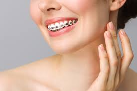 How Orthodontics Improves Smile Function
