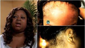 Most wear cornrows underneath their wigs so they can lay flat, but when you're switching out units and enjoying playing with your look, it's easy to forget that the hair you've got growing from. Do Lace Front Wigs Damage Hair Naturallycurly Com