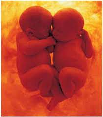 twins conversation in the womb twins in the womb after birth twins
