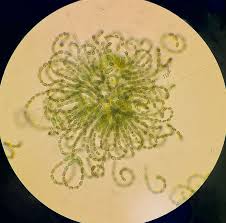 Last week, there was a late-season blue-green algae bloom in Sandy Lake…