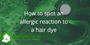 As said earlier, hair dye allergy symptoms could be mild or severe. How To Spot An Allergic Reaction To Hair Dye I Read Labels For You