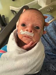 Long story short. Growth scan has the babies belly measuring in the 96th  percentile. Dr warned me there's a strong chance of shoulder dystocia.. I  am honestly horrified by this, esp since