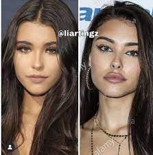 There has been a lot of talk about madison beer plastic surgery but she insists this is not the case. Pin On Plastic Surgery Before After Plastic Surgery Celebrity Plastic Surgery Injectables Fillers