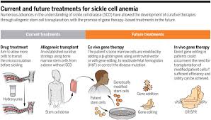 These traits make them clump together, blocking blood vessels and impairing blood flow. Treating Sickle Cell Anemia Science