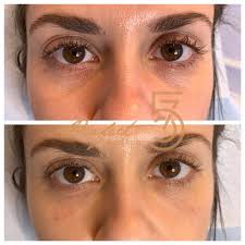 TOP 10 BEST Medspa near Armonk, NY