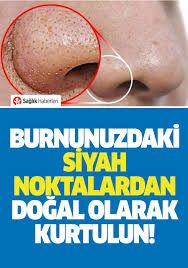 Burnunuzdaki Siyah Noktalardan Kurtulmaniz Icin Yapmaniz Gerekenler Siyah Noktalar Cilt Bakimi Tuyolari Organik Cilt Bakimi