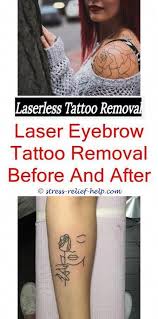 Premium tattoo removal is about professional tattoo removal and modification. Laser Tattoo Removal Houston How Much Tattoo Removal Cost With Laser How Much Is A Tattoo Removal Machi Tattoo Removal Cost Laser Tattoo Eyebrow Tattoo Removal