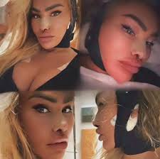 Darcey's transformation after surgery