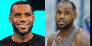 El trasplante de cabello de LeBron James: impacto, técnicas y tendencias  entre las celebridades