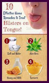 Pin By Kamariah Tan On Health Blister On Tongue Remedies Blister Remedies