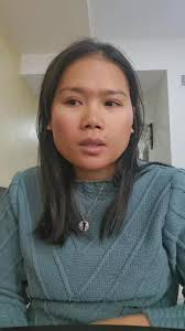 This happened last March, this is just a minor operation called frenillo  lengua. Gupitan gamay ang under tongue niya para mkalitok ug mka storya ug  tarong. #fbreelsfypシ゚viralシ #reelsviral #fbreelsfyp #fbreelsviral