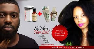 Hair Loss/ Baldness...