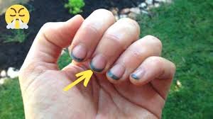 Jardinage L Astuce De Genie Pour Ne Plus Jamais Avoir Les Ongles Noirs Astuces Ongle Noir Jardinage