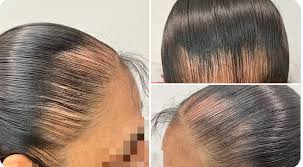 que eres fan de la coleta 