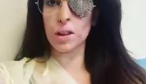 Contact gessica notaro on messenger. Cesena Gessica Notaro Operata A Un Occhio Il Manager Sta Bene