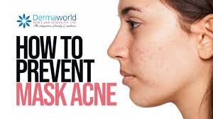 While most of them do not face any problem importantly, steer clear of the hair dye that caused the allergic response; Hair Dye Reactions Causes Diagnosis Symptoms And Treatment Youtube